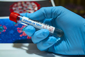 Photo of Nigeria records 566 new cases of coronavirus, number of infections jumps to 25,133